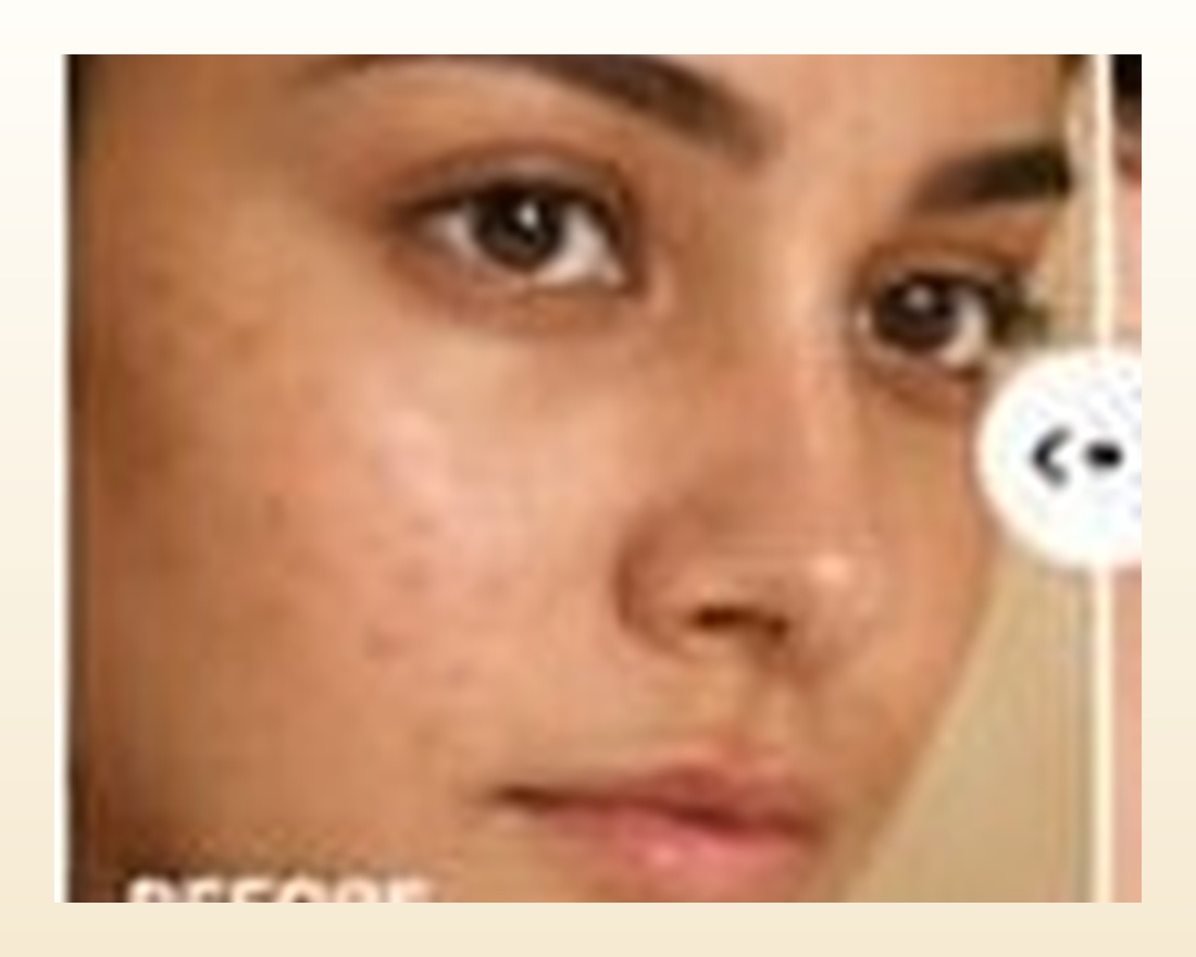 Before skincare result